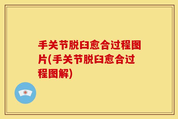 手关节脱臼愈合过程图片(手关节脱臼愈合过程图解)