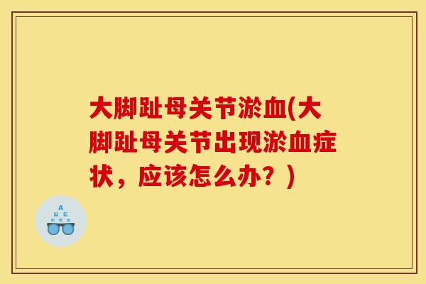 大脚趾母关节淤血(大脚趾母关节出现淤血症状，应该怎么办？)