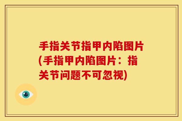 手指关节指甲内陷图片(手指甲内陷图片：指关节问题不可忽视)