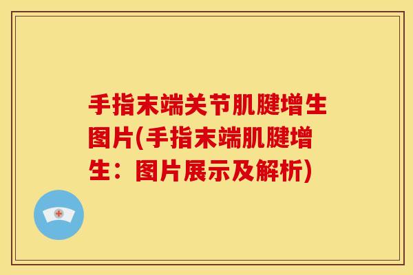 手指末端关节肌腱增生图片(手指末端肌腱增生：图片展示及解析)