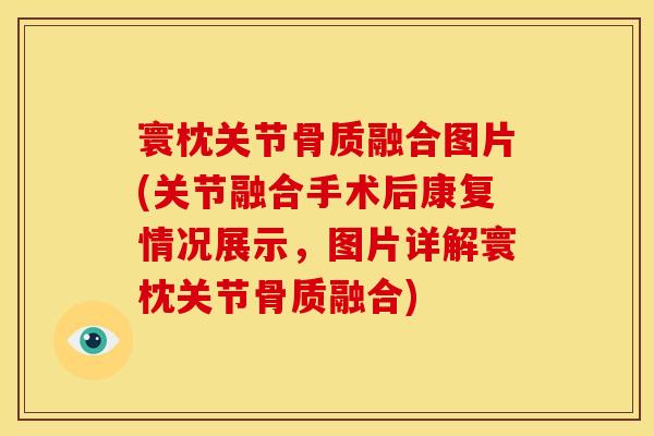 寰枕关节骨质融合图片(关节融合手术后康复情况展示，图片详解寰枕关节骨质融合)