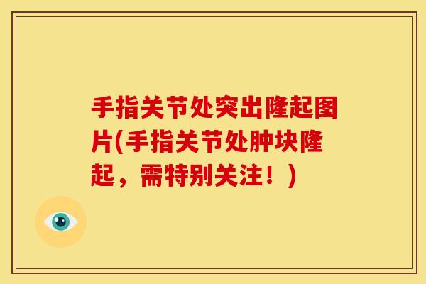 手指关节处突出隆起图片(手指关节处肿块隆起，需特别关注！)