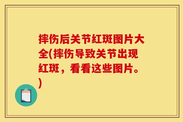 摔伤后关节红斑图片大全(摔伤导致关节出现红斑，看看这些图片。)