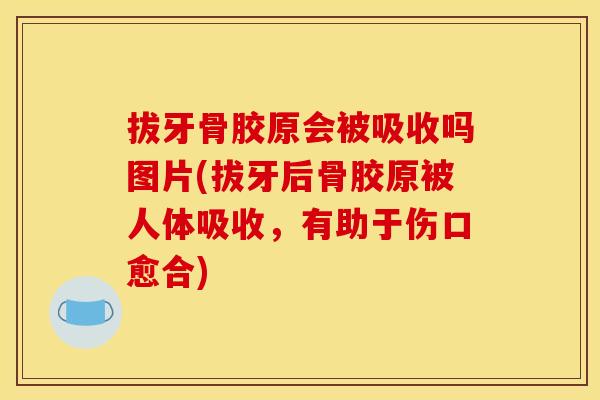 拔牙骨胶原会被吸收吗图片(拔牙后骨胶原被人体吸收，有助于伤口愈合)