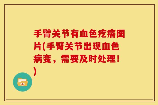 手臂关节有血色疙瘩图片(手臂关节出现血色病变，需要及时处理！)