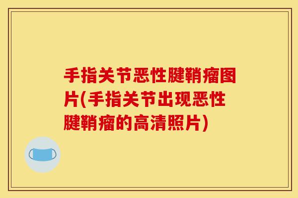 手指关节恶性腱鞘瘤图片(手指关节出现恶性腱鞘瘤的高清照片)