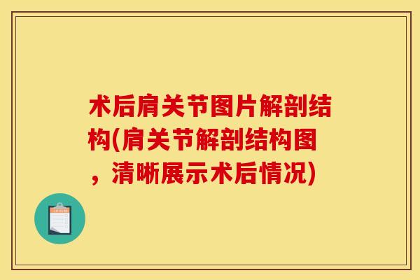 术后肩关节图片解剖结构(肩关节解剖结构图，清晰展示术后情况)