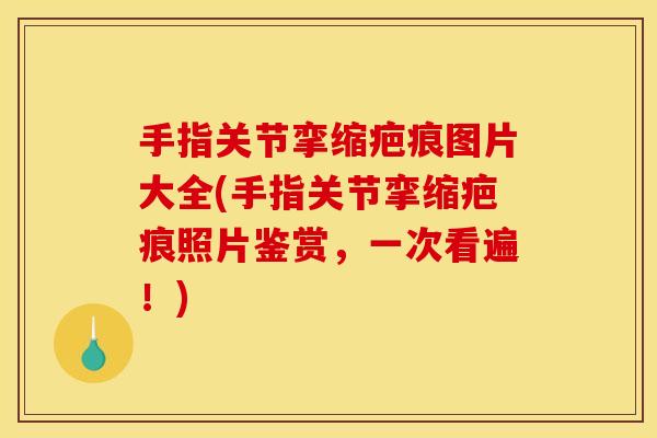 手指关节挛缩疤痕图片大全(手指关节挛缩疤痕照片鉴赏，一次看遍！)