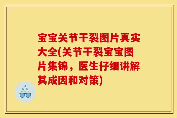 宝宝关节干裂图片真实大全(关节干裂宝宝图片集锦，医生仔细讲解其成因和对策)