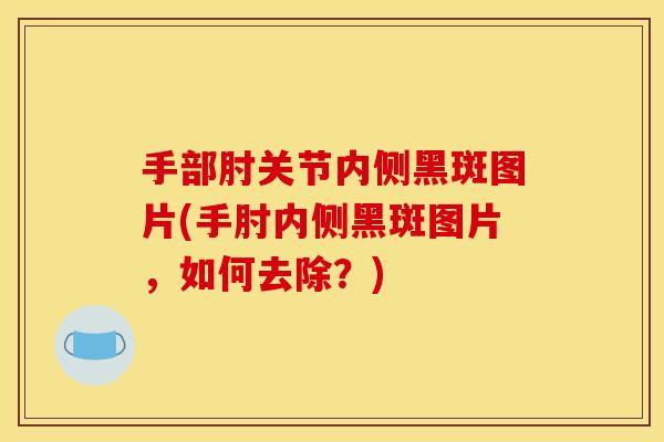 手部肘关节内侧黑斑图片(手肘内侧黑斑图片，如何去除？)