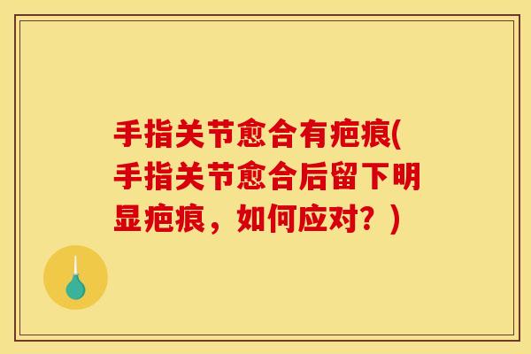 手指关节愈合有疤痕(手指关节愈合后留下明显疤痕，如何应对？)