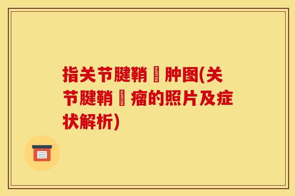 指关节腱鞘蘘肿图(关节腱鞘腫瘤的照片及症状解析)