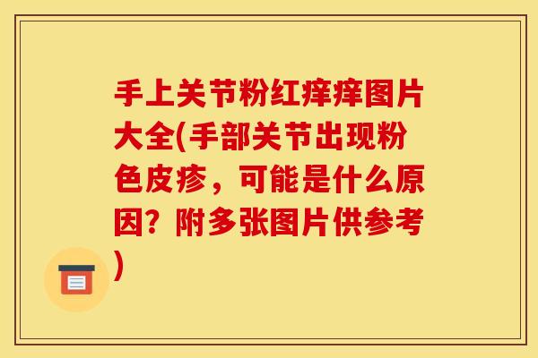 手上关节粉红痒痒图片大全(手部关节出现粉色皮疹，可能是什么原因？附多张图片供参考)