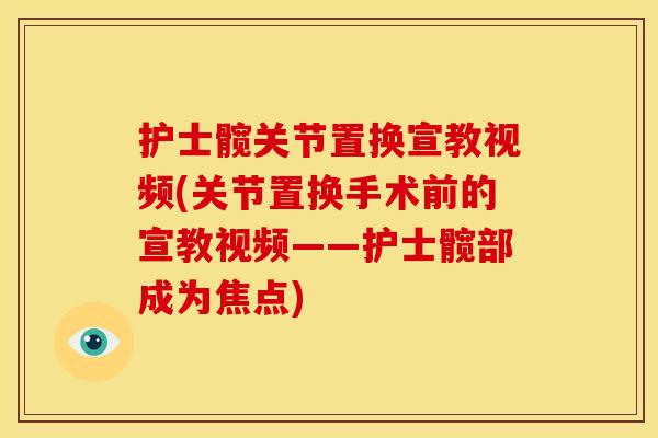 护士髋关节置换宣教视频(关节置换手术前的宣教视频——护士髋部成为焦点)