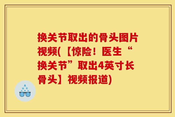 换关节取出的骨头图片视频(【惊险！医生“换关节”取出4英寸长骨头】视频报道)