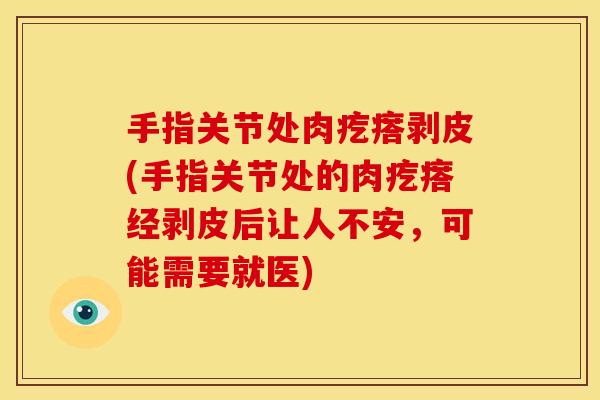 手指关节处肉疙瘩剥皮(手指关节处的肉疙瘩经剥皮后让人不安，可能需要就医)