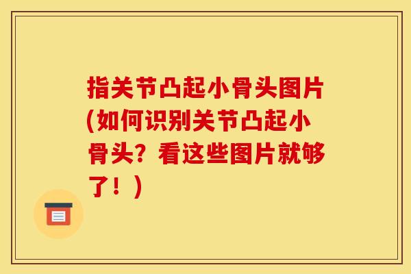 指关节凸起小骨头图片(如何识别关节凸起小骨头？看这些图片就够了！)