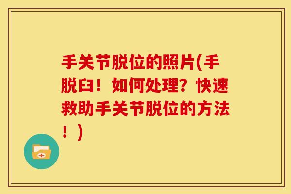 手关节脱位的照片(手脱臼！如何处理？快速救助手关节脱位的方法！)