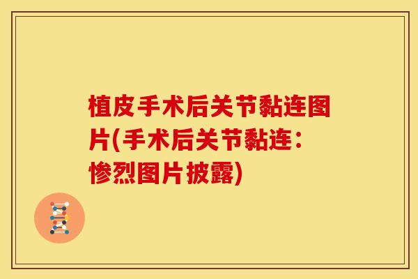 植皮手术后关节黏连图片(手术后关节黏连：惨烈图片披露)