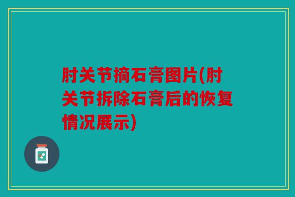 肘关节摘石膏图片(肘关节拆除石膏后的恢复情况展示)