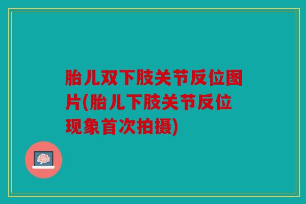 胎儿双下肢关节反位图片(胎儿下肢关节反位现象首次拍摄)