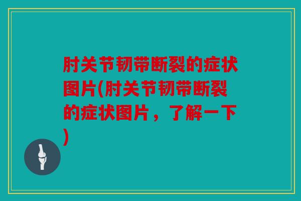 肘关节韧带断裂的症状图片(肘关节韧带断裂的症状图片，了解一下)