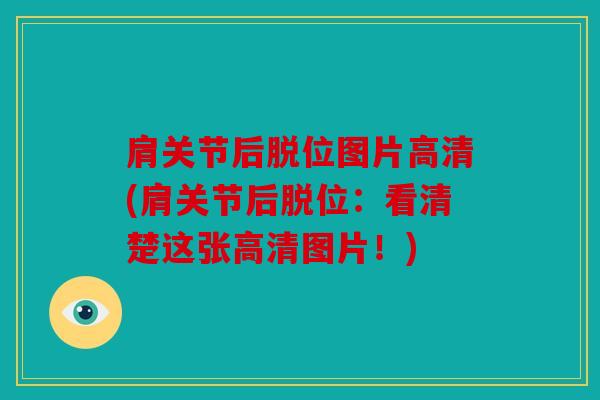 肩关节后脱位图片高清(肩关节后脱位：看清楚这张高清图片！)