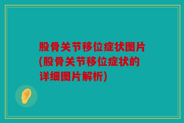 股骨关节移位症状图片(股骨关节移位症状的详细图片解析)