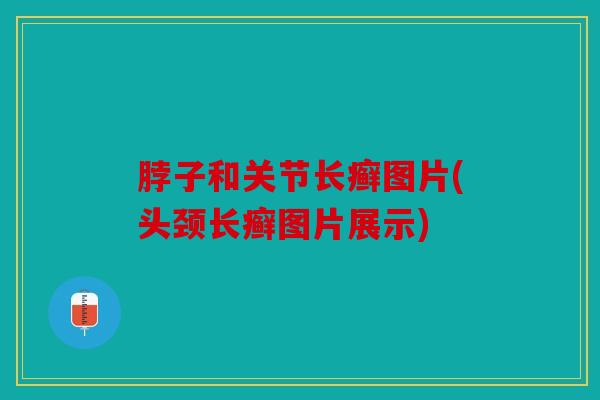 脖子和关节长癣图片(头颈长癣图片展示)