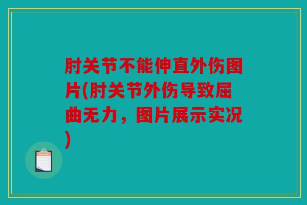 肘关节不能伸直外伤图片(肘关节外伤导致屈曲无力，图片展示实况)