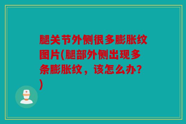 腿关节外侧很多膨胀纹图片(腿部外侧出现多条膨胀纹，该怎么办？)