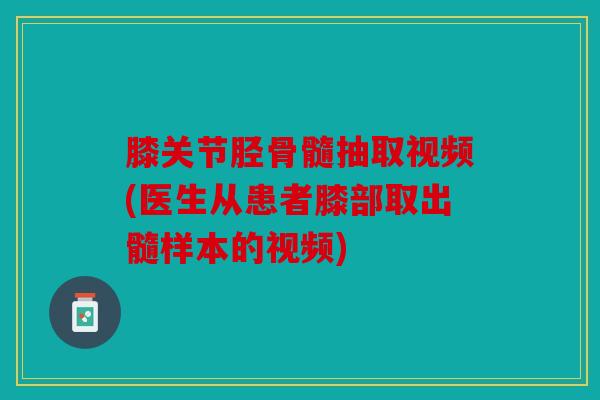 膝关节胫骨髓抽取视频(医生从患者膝部取出髓样本的视频)