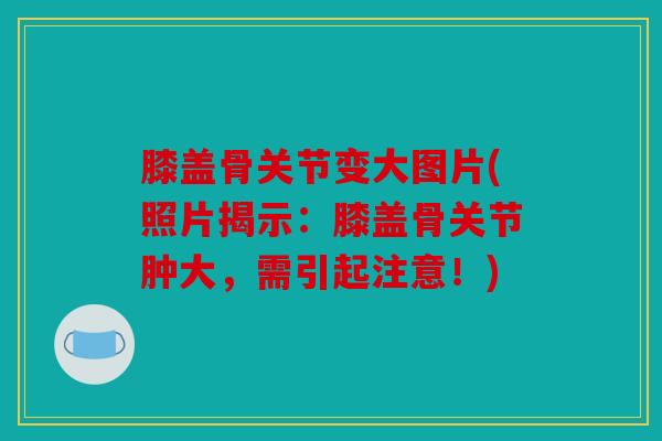 膝盖骨关节变大图片(照片揭示：膝盖骨关节肿大，需引起注意！)