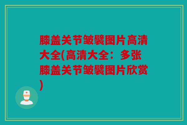 膝盖关节皱襞图片高清大全(高清大全：多张膝盖关节皱襞图片欣赏)