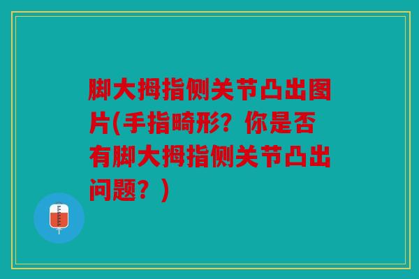 脚大拇指侧关节凸出图片(手指畸形？你是否有脚大拇指侧关节凸出问题？)