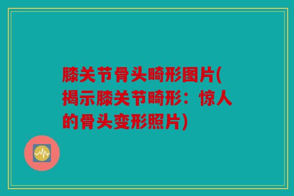 膝关节骨头畸形图片(揭示膝关节畸形：惊人的骨头变形照片)