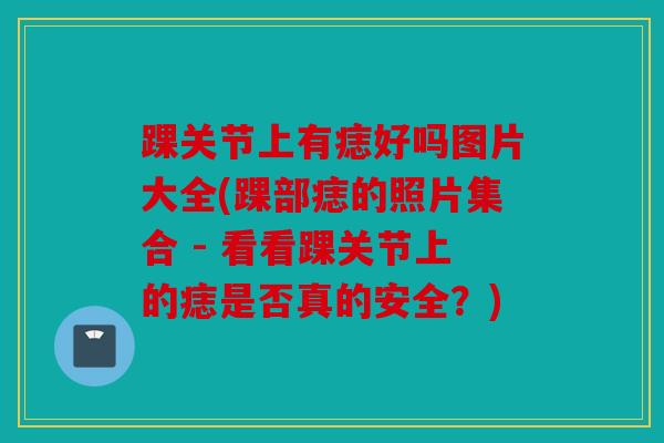 踝关节上有痣好吗图片大全(踝部痣的照片集合 - 看看踝关节上的痣是否真的安全？)