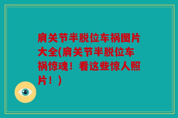 肩关节半脱位车祸图片大全(肩关节半脱位车祸惊魂！看这些惊人照片！)