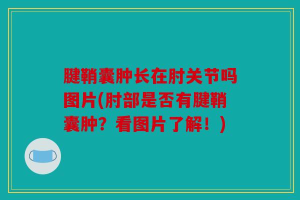 腱鞘囊肿长在肘关节吗图片(肘部是否有腱鞘囊肿？看图片了解！)