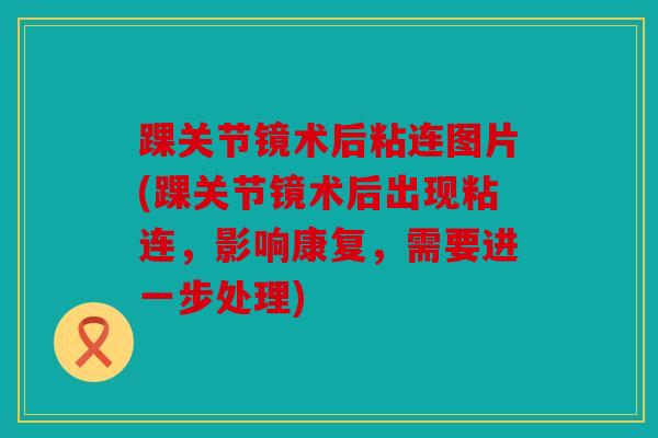 踝关节镜术后粘连图片(踝关节镜术后出现粘连，影响康复，需要进一步处理)