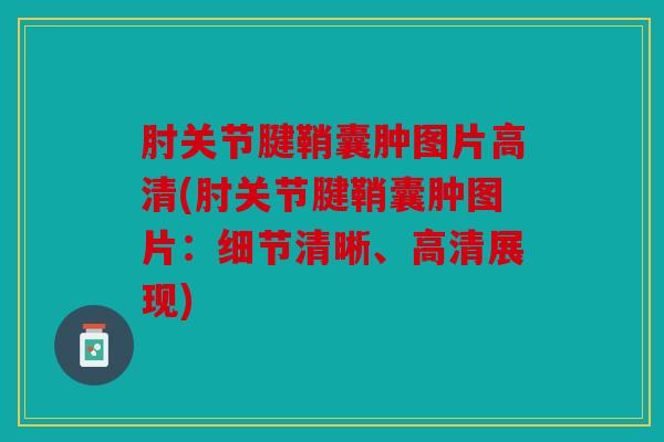 肘关节腱鞘囊肿图片高清(肘关节腱鞘囊肿图片：细节清晰、高清展现)